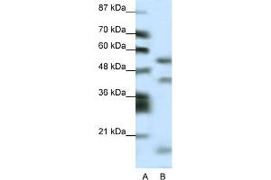 WB Suggested Anti-LHX1 Antibody Titration:  0. (LHX1 抗体  (N-Term))