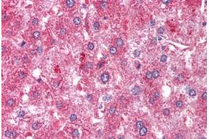 Human Liver (formalin-fixed, paraffin-embedded) stained with ATM antibody ABIN213900 at 1-2 ug/ml followed by biotinylated goat anti-rabbit IgG secondary antibody ABIN481713, alkaline phosphatase-streptavidin and chromogen. (ATM 抗体  (C-Term))