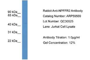 WB Suggested Anti-NPFFR2  Antibody Titration: 0. (NPFFR2 抗体  (Middle Region))