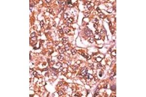 Image no. 2 for anti-Retinoblastoma 1 (RB1) (pSer612) antibody (ABIN358212) (Retinoblastoma 1 抗体  (pSer612))