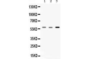Western blot analysis of Catalase expression in rat skeletal muscle extract ( Lane 1), mouse skeletal muscle extract ( Lane 2) and A549 whole cell lysates ( Lane 3). (Catalase 抗体  (AA 344-527))