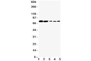 Western blot testing of SGLT1 antibody and Lane 1:  rat kidney;  2: (r) heart;  3: human HeLa;  4: (h) SW620;  5: (h) COLO320 cell lysate. (SLC5A1 抗体  (C-Term))