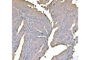 IHC analysis of PKM2 using anti-PKM2 antibody (ABIN7603151).