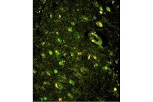 Immunofluorescence (IF) image for anti-KH-Type Splicing Regulatory Protein (KHSRP) (AA 94-122), (N-Term) antibody (ABIN390852)
