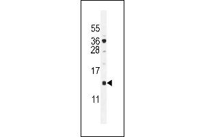 SFT2D2 Antibody (N-term) (ABIN655101 and ABIN2844733) western blot analysis in  cell line lysates (35 μg/lane). (SFT2D2 抗体  (N-Term))
