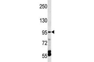 TRPV5 antibody western blot analysis in HepG2 lysate. (TRPV5 抗体  (AA 634-663))