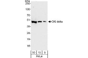 anti-Casein Kinase 1, delta (CSNK1D) (AA 359-409) antibody