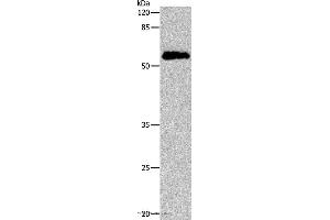 Western blot analysis of Human cervical cancer tissue, using CDC20 Polyclonal Antibody at dilution of 1:600 (CDC20 抗体)
