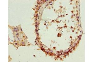 Immunohistochemistry of paraffin-embedded human testis tissue using ABIN7172454 at dilution of 1:100 (TCF19 抗体  (AA 1-290))