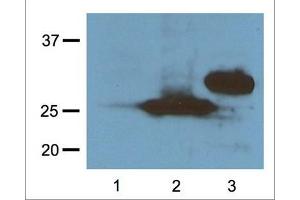 1:1000 (1μg/mL) Ab dilution probed against HEK293 cells transfected with RFP-tagged protein vector, untransfected control (1), transfected with Turbo-RFP (2), and transfected with DeRed (3) (RFP 抗体  (N-Term))