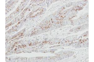 Immunohistochemistry (IHC) image for anti-UDP-N-Acetyl-alpha-D-Galactosamine:polypeptide N-Acetylgalactosaminyltransferase 2 (GalNAc-T2) (GALNT2) antibody (ABIN2855761)