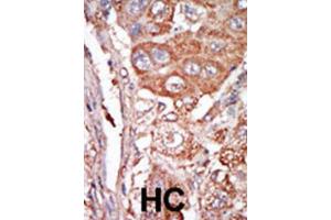 Immunohistochemistry (IHC) image for anti-Fibroblast Growth Factor 4 (FGF4) antibody (ABIN3003719) (FGF4 抗体)