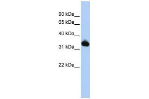 GALM antibody used at 1 ug/ml to detect target protein. (GALM 抗体)
