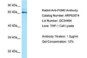 Western Blotting (WB) image for anti-Phosphoglucomutase 2 (PGM2) (C-Term) antibody (ABIN2774378) (Phosphoglucomutase 2 抗体  (C-Term))