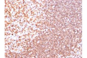Formalin-fixed, paraffin-embedded human Tonsil stained with CD74 Ab (SPM523). (CD74 抗体)