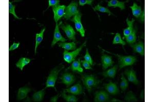 Immunofluorescence staining of NIH/3T3 cells with ABIN7158272 at 1:100, counter-stained with DAPI. (LILRB3 抗体  (AA 470-624))