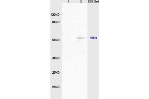 Lane 1: mouse brain lysates Lane 2: mouse heart lysates probed with Anti ACTRIC/Activin A Receptor Type IC Polyclonal Antibody, Unconjugated (ABIN714596) at 1:200 in 4 °C. (ACVR1C/ALK7 抗体  (AA 21-120))