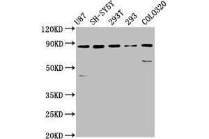 Western Blot Positive WB detected in: U87 whole cell lysate, SH-SY5Y whole cell lysate, 293T whole cell lysate, 293 whole cell lysate, Colo320 whole cell lysate All lanes: SLC26A4 antibody at 5. (SLC26A4 抗体  (AA 592-655))