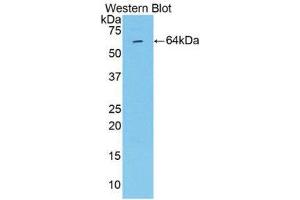 Western Blotting (WB) image for anti-Matrix Metalloproteinase 2 (MMP2) (AA 110-660) antibody (ABIN1859851) (MMP2 抗体  (AA 110-660))