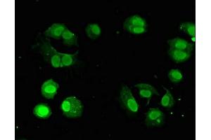 anti-Guanine Nucleotide Binding Protein (G Protein), Q Polypeptide (GNAQ) (AA 1-359) antibody