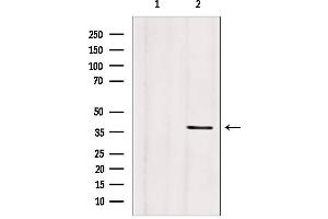 Western blot analysis of extracts from mouse brain, using CLTA antibody. (CLTA 抗体)