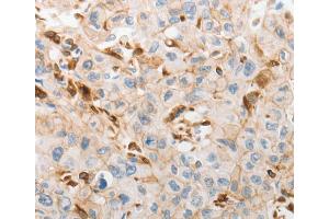 Immunohistochemistry (IHC) image for anti-Solute Carrier Family 15 (H+/Peptide Transporter), Member 2 (SLC15A2) antibody (ABIN2431771) (SLC15A2 抗体)