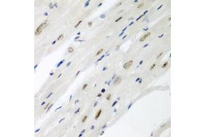 Immunohistochemistry of paraffin-embedded mouse heart using CDC27 antibody (ABIN3015756, ABIN3015757, ABIN1679113 and ABIN6219104) at dilution of 1:200 (40x lens). (CDC27 抗体  (AA 551-830))
