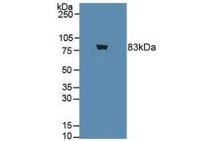 Choline Acetyltransferase 抗体  (AA 517-732)