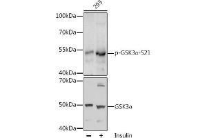 Western blot analysis of extracts of 293 cells, using Phospho-GSK3α-S21 antibody (ABIN6135231, ABIN6136096, ABIN6136097 and ABIN6225606) at 1:1000 dilution or GSK3α antibody (ABIN1680131, ABIN3015275, ABIN3015276 and ABIN6213918). (GSK3 alpha 抗体  (pSer21))