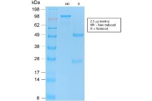 SDS-PAGE Analysis of Purified TP53 Rabbit Recombinant Monoclonal Antibody ABIN6383819. (Recombinant p53 抗体  (AA 16-25))
