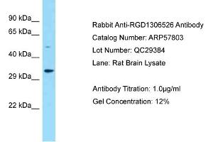 Western Blotting (WB) image for anti-Family with Sequence Similarity 212, Member B (FAM212B) (Middle Region) antibody (ABIN2787401) (FAM212B 抗体  (Middle Region))
