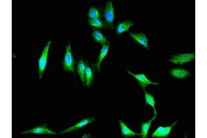 Immunofluorescent analysis of Hela cells using ABIN7152863 at dilution of 1:100 and Alexa Fluor 488-congugated AffiniPure Goat Anti-Rabbit IgG(H+L) (PKHD1 抗体  (AA 520-743))