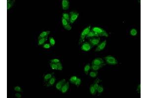 Immunofluorescence staining of HepG2 cells with ABIN7153038 at 1:166, counter-stained with DAPI. (FOXE3 抗体  (AA 4-74))