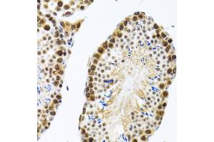 Immunohistochemistry of paraffin-embedded rat testis using CIRBP antibody. (CIRBP 抗体)