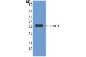 Detection of Recombinant IAP, Mouse using Polyclonal Antibody to Integrin Associated Protein (IAP) (CD47 抗体  (AA 18-219))