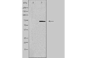 Western blot analysis of extracts from Jurkat cells, using PLA2G4C antibody. (PLA2G4C 抗体  (Internal Region))