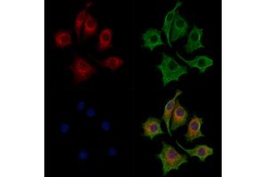 ABIN7094336 and ABIN7098383 staining HepG2 cells by IF/ICC. (Ceramide Synthase 2 抗体  (C-Term))