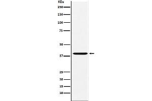 Western blot analysis of CAPG expression in HeLa cell lysate.
