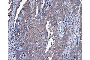 IHC analysis of Dicer/DICER1 using anti-Dicer/DICER1 antibody (ABIN3043347).
