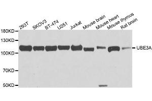 Western blot analysis of extracts of various cell lines, using UBE3A antibody. (ube3a 抗体  (AA 300-590))