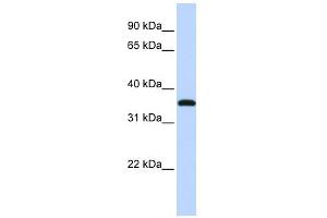 VGLL3 antibody used at 1 ug/ml to detect target protein. (VGLL3 抗体)