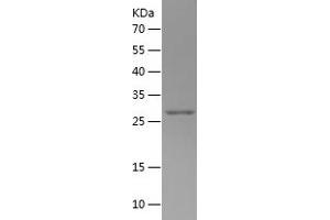 Western Blotting (WB) image for Galectin 3 (LGALS3) (AA 4-262) protein (His tag) (ABIN7123044)