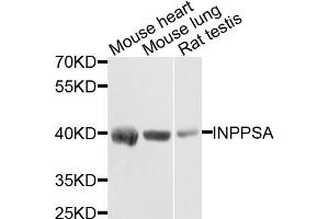 Western blot analysis of extracts of various cell lines, using INPP5A antibody (ABIN5971690) at 1/1000 dilution. (INPP5A 抗体)