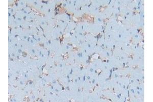 Detection of S100A6 in Rat Heart Tissue using Polyclonal Antibody to S100 Calcium Binding Protein A6 (S100A6) (S100A6 抗体  (AA 1-89))