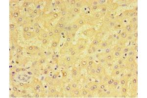 Immunohistochemistry of paraffin-embedded human liver tissue using ABIN7143385 at dilution of 1:100 (F4/80 抗体  (AA 21-290))