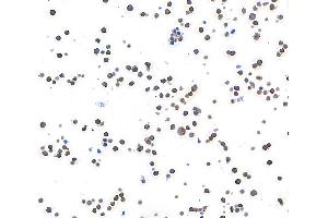 Immunocytochemistry (ICC) image for anti-Metastasis Associated in Colon Cancer 1 (MACC1) (AA 100-150) antibody (ABIN7453975) (Recombinant MACC1 抗体  (AA 100-150))