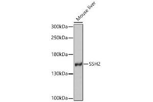 Western blot analysis of extracts of various cell lines, using SSH2 antibody (ABIN4905305) at 1:1000 dilution. (JAM2 抗体)