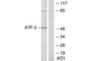 Western Blotting (WB) image for anti-Activating Transcription Factor 2 (ATF2) (AA 38-87) antibody (ABIN2888951) (ATF2 抗体  (AA 38-87))