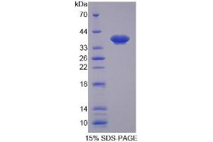 SDS-PAGE analysis of Human SLC25A39 Protein. (SLC25A39 蛋白)