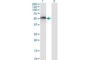 Western Blot analysis of SPP1 expression in transfected 293T cell line by SPP1 monoclonal antibody (M17), clone 3G6. (Osteopontin 抗体  (AA 21-129))